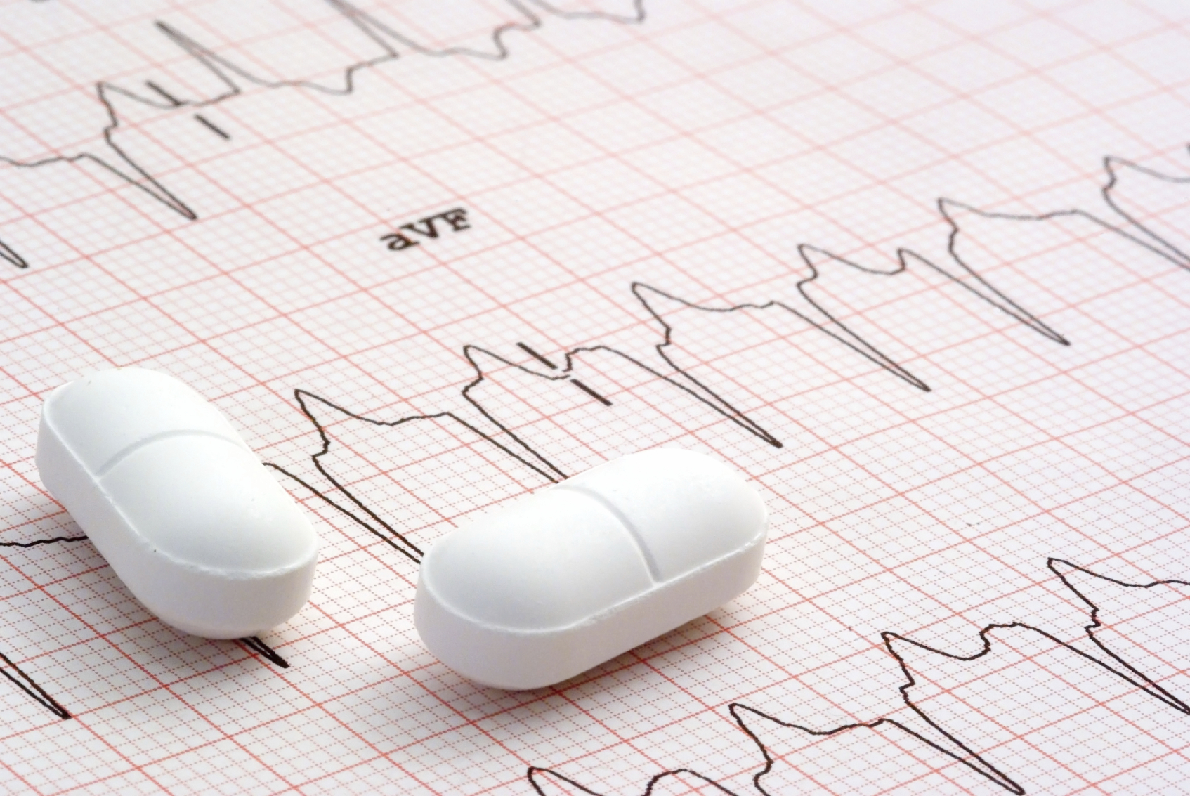 L’irrégularité du rythme cardiaque est un effet secondaire possible des médicaments contre l’ostéoporose