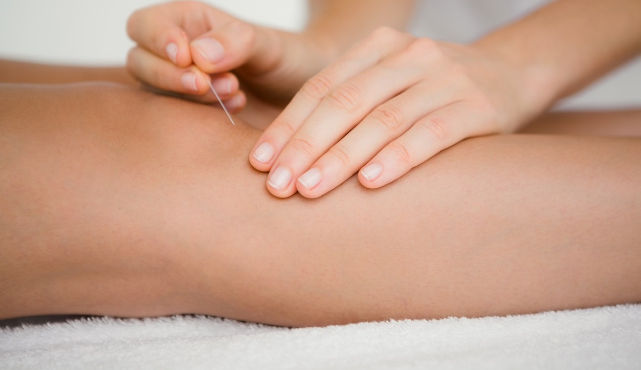 Des douleurs aux genoux ? Qu’en est-il de l’acupuncture ?
