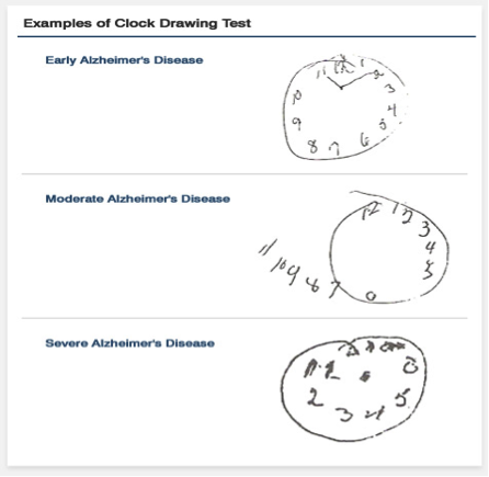 clock-drawing-test